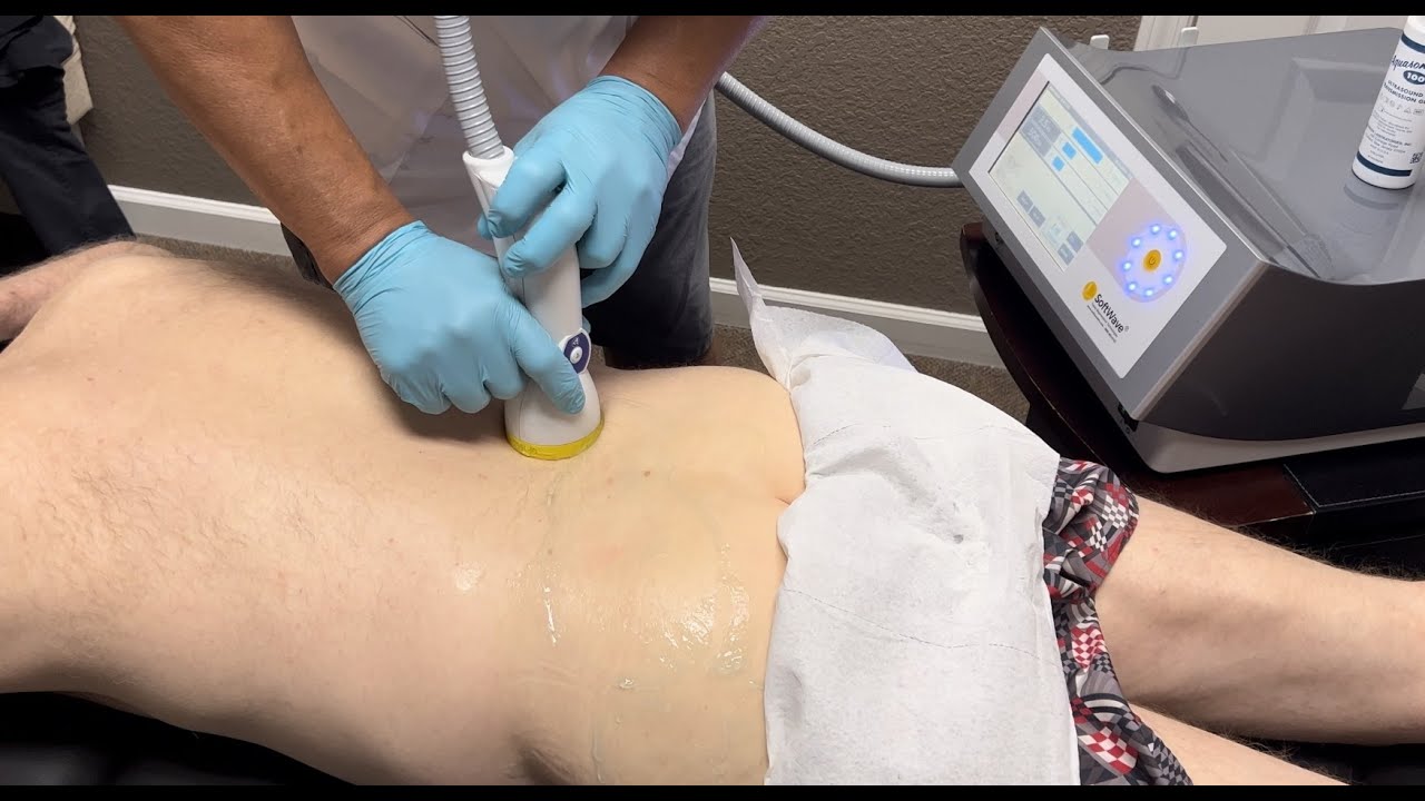 Chris - Shockwave Therapy - SI Joint, Low Back, Hip