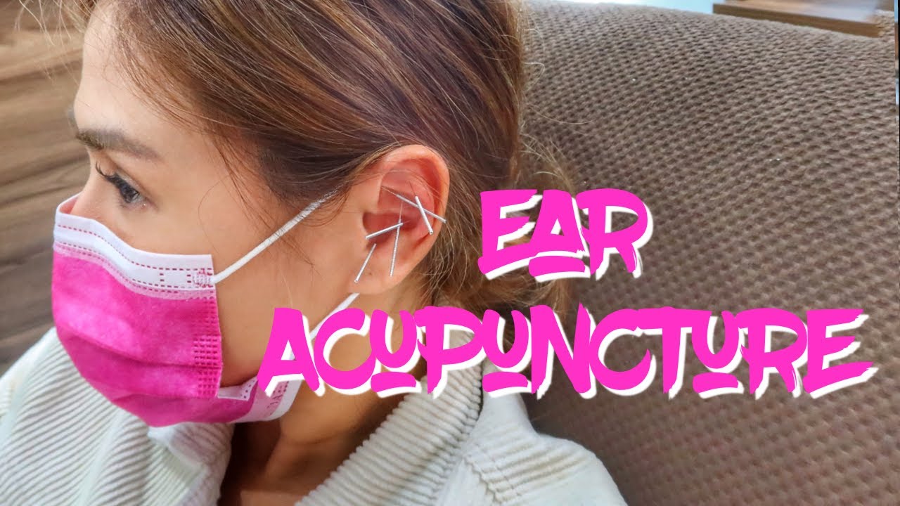 EAR (AURICULAR) ACUPUNCTURE TO REDUCE STRESS AND DETOXIFY | Valerie Tan