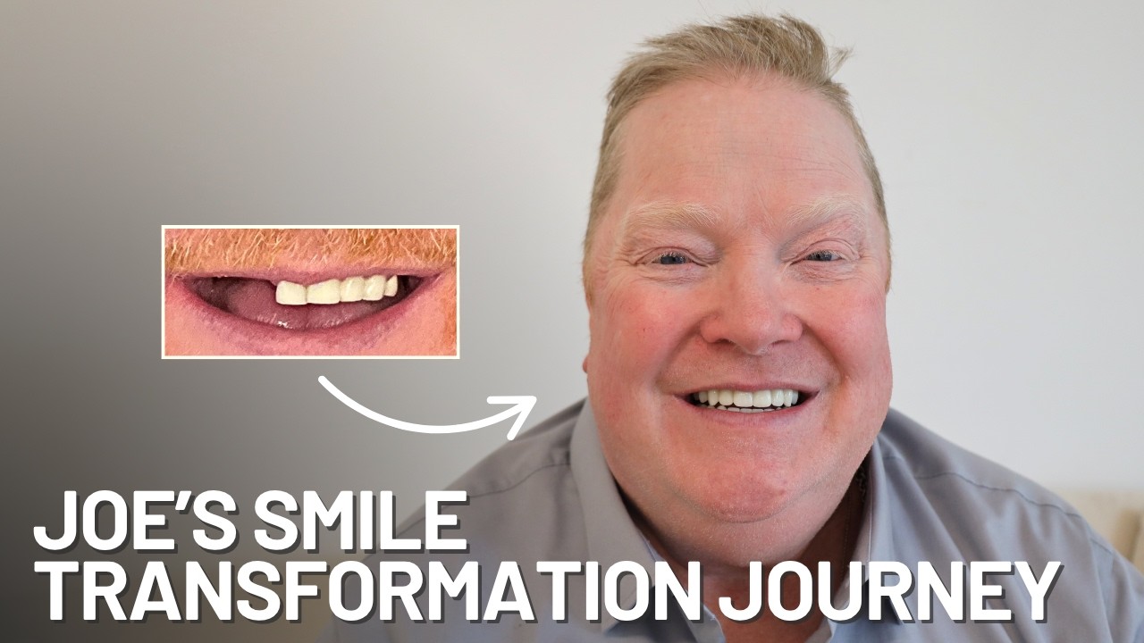 From Gum Disease and Missing Teeth to a Perfect Smile | Joe's Dental Implant Journey