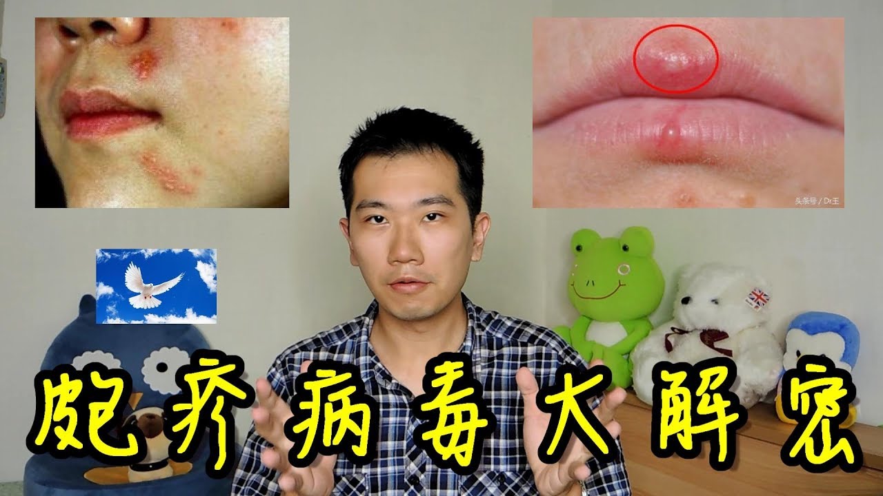 嘴唇上長皰疹是怎麼回事? 能預防嗎? 單純皰疹大解密! | 三分鐘聊醫學EP22