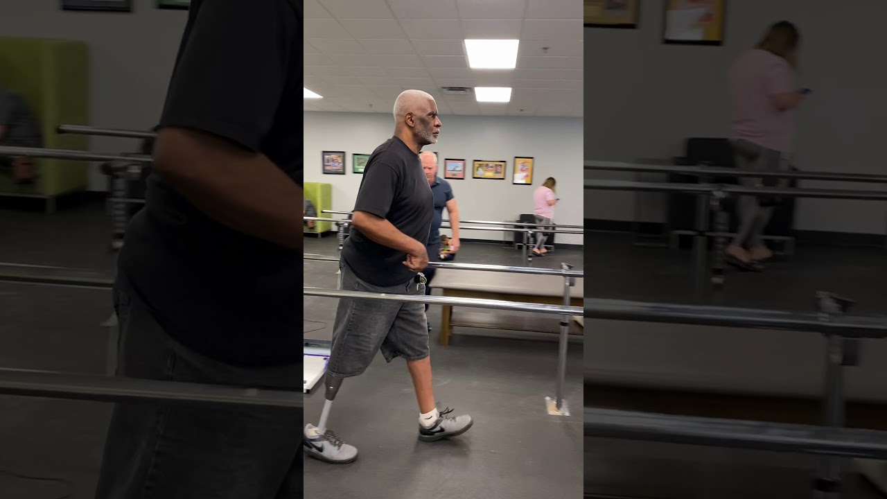 Michael, AK Amputee, Walking on C-Leg Microprocessor For First Time