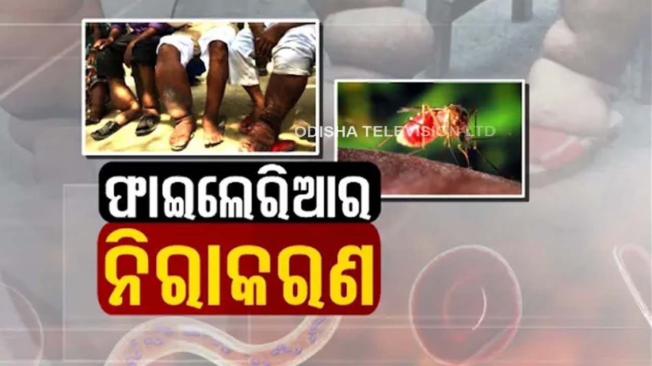 Doctor Doctor | What Is Filariasis ? - Causes, Symptoms, Diagnosis & Treatment