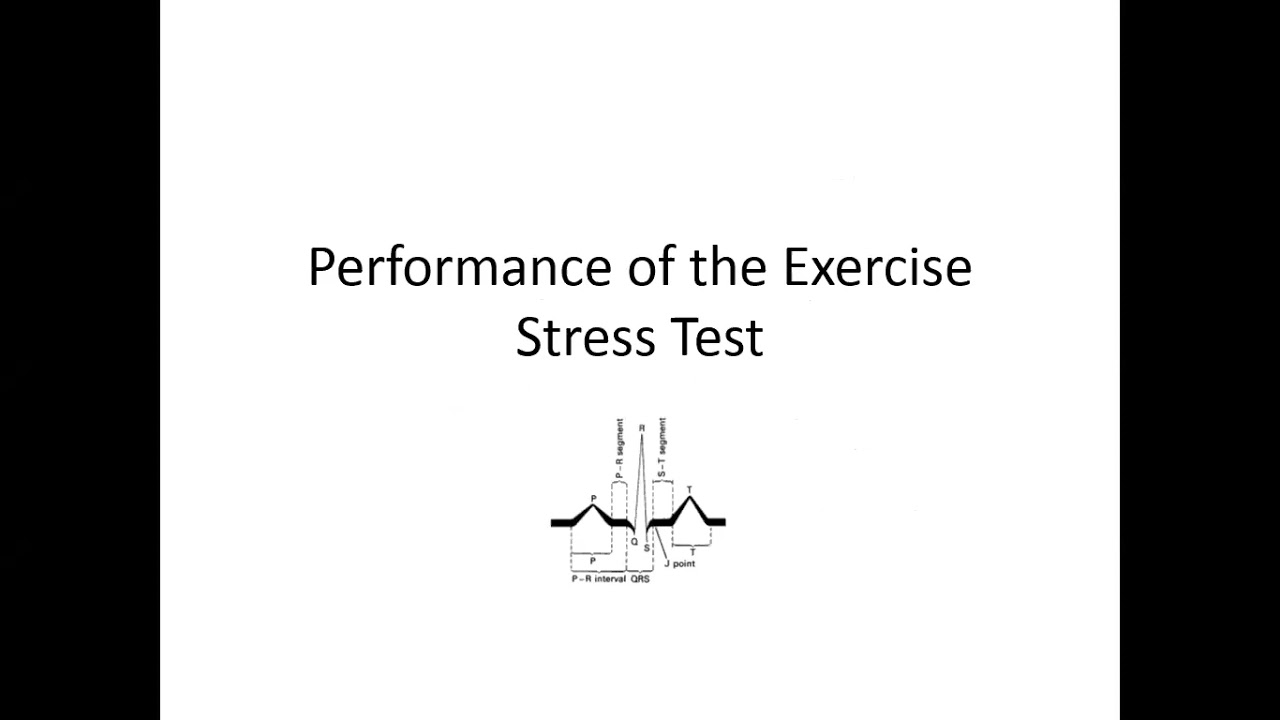 2- Exercise ECG - Dr. Ahmed Talaat