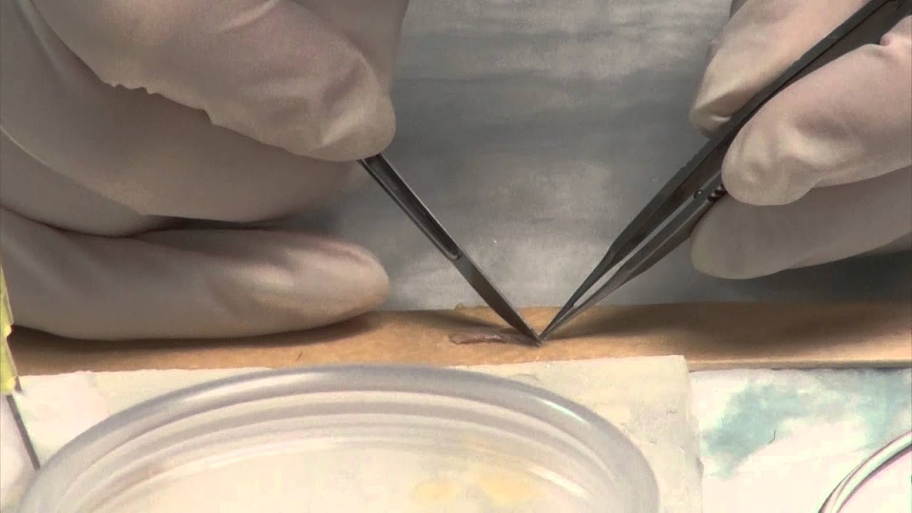 Hair Transplant Graft Dissection & Preparation Lecture & Tutorial