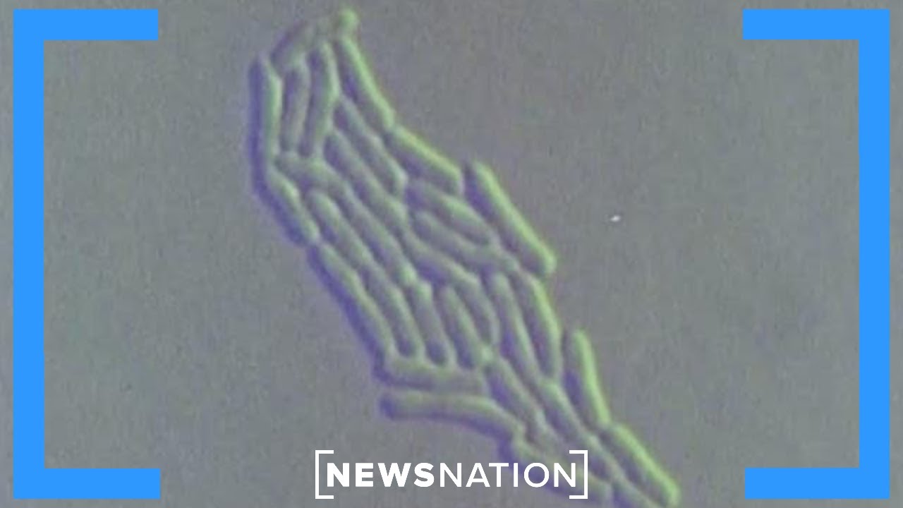 Research connects colon cancer rates to childhood toxin exposure | Morning in America