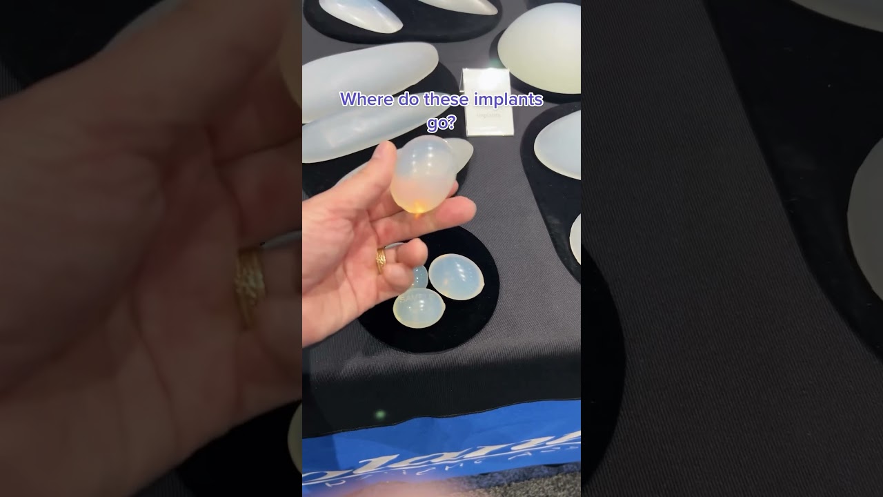 Where Do These Implants Go?