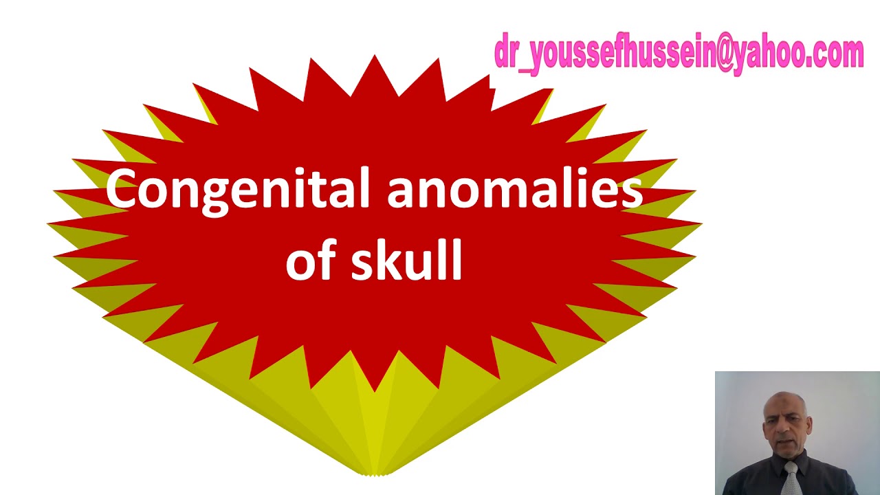 Development of the skull | Congenital anomalies | Fontanelle | Anencephaly | Scaphocephaly |