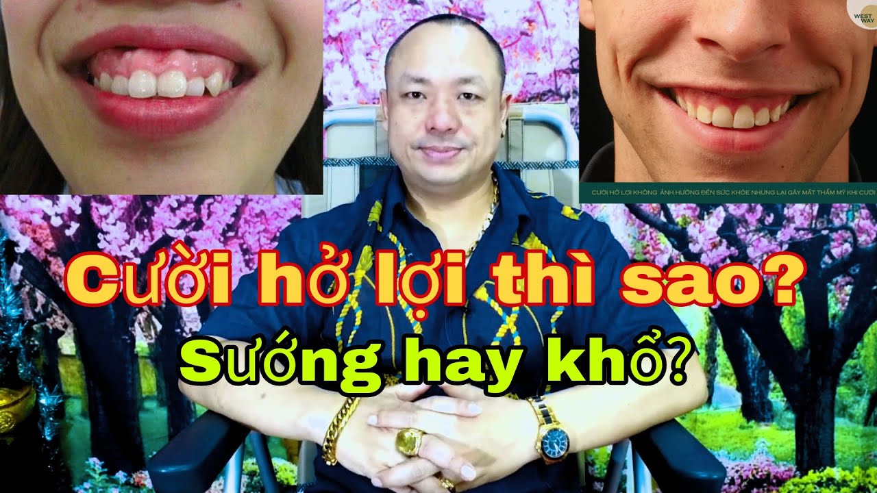 Xem tướng đàn ông, phụ nữ cười hở lợi. Sướng hay khổ?