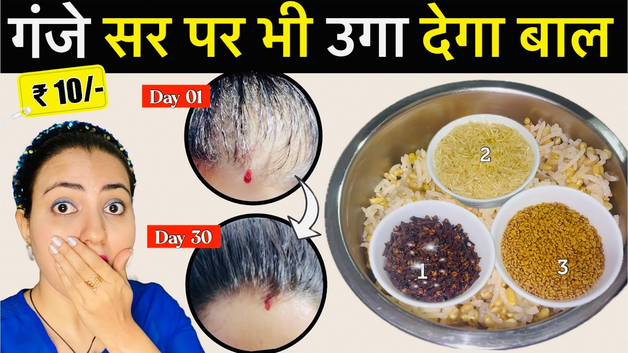 30 Days Challenge : कैसा भी गंजापन पतले कमजोर झड़ते बाल हों, इस Remedy से उगेंगे दोगुनी तेजी से बाल❤️