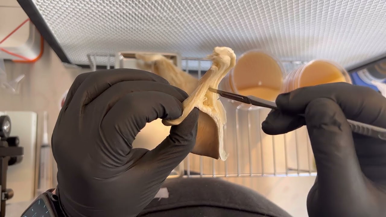 Cloning wild oyster mushrooms onto agar