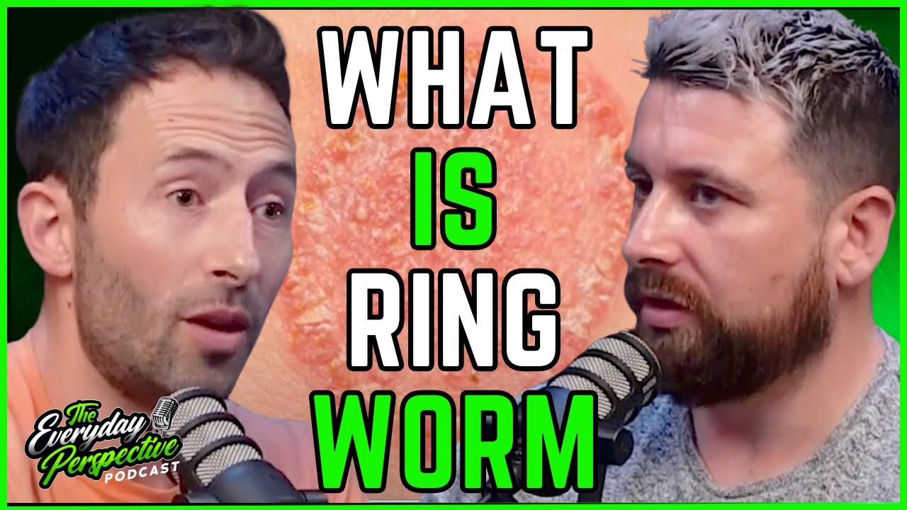 Doctor Explains Ringworm (aka Tinea) Incl. Symptoms, Causes & Treatment | Everyday Perspective Clips