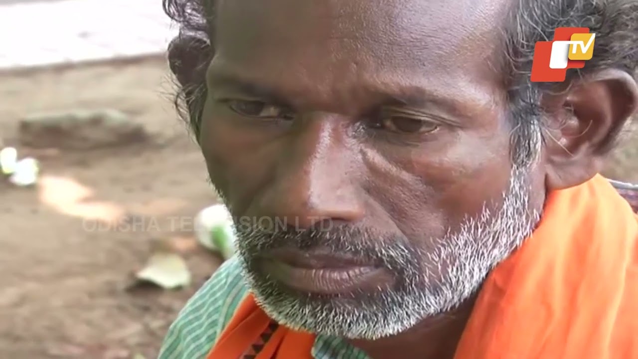 Balasore acid attack victim succumbs to burn injuries at SCB