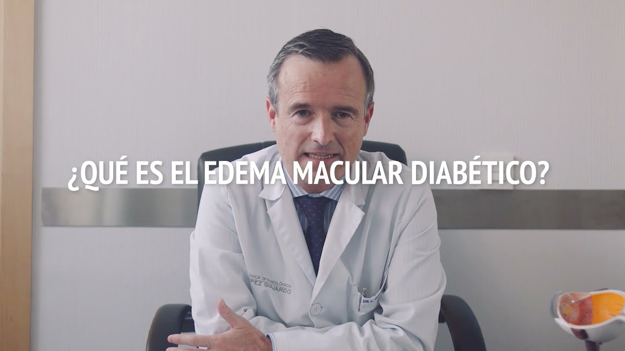 Edema Macular Diabético - Dr. López Guajardo