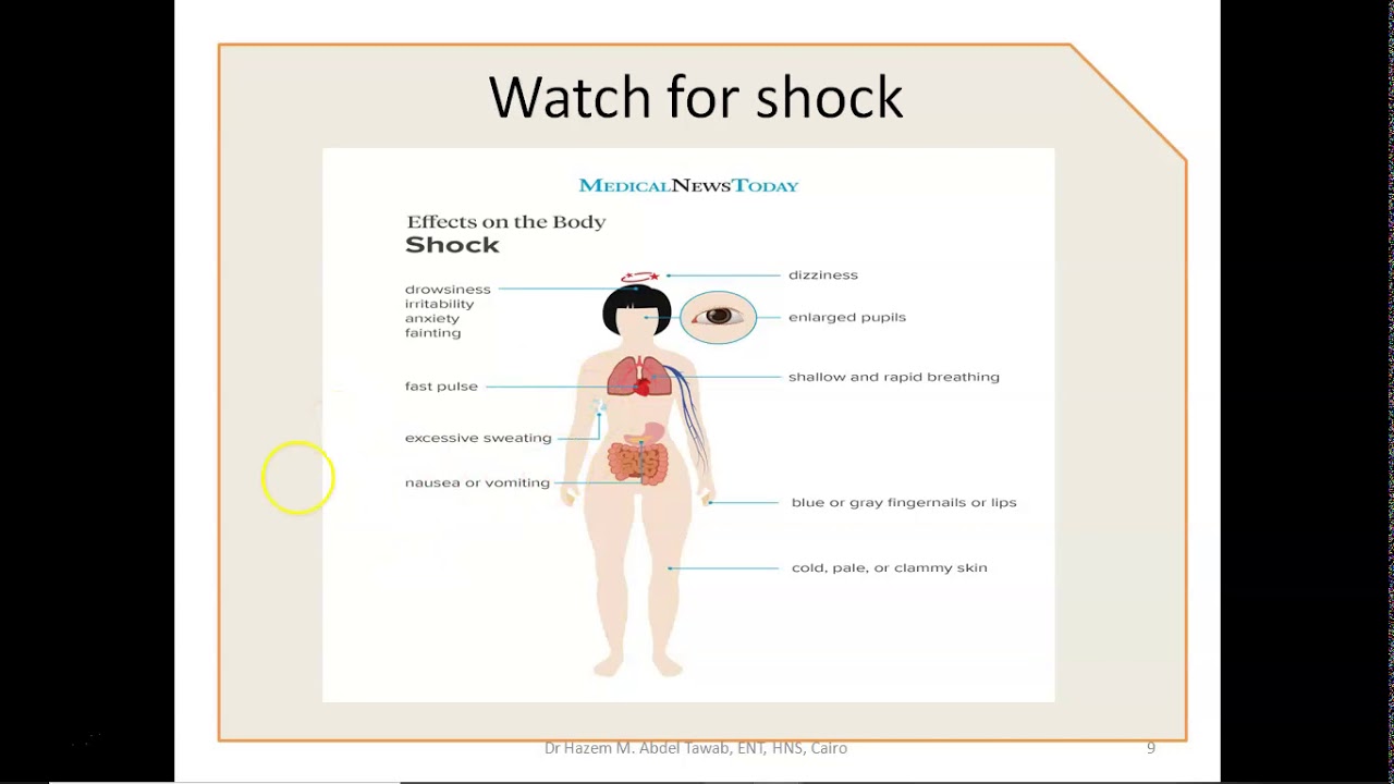 Epistaxis Causes and Management Part 2