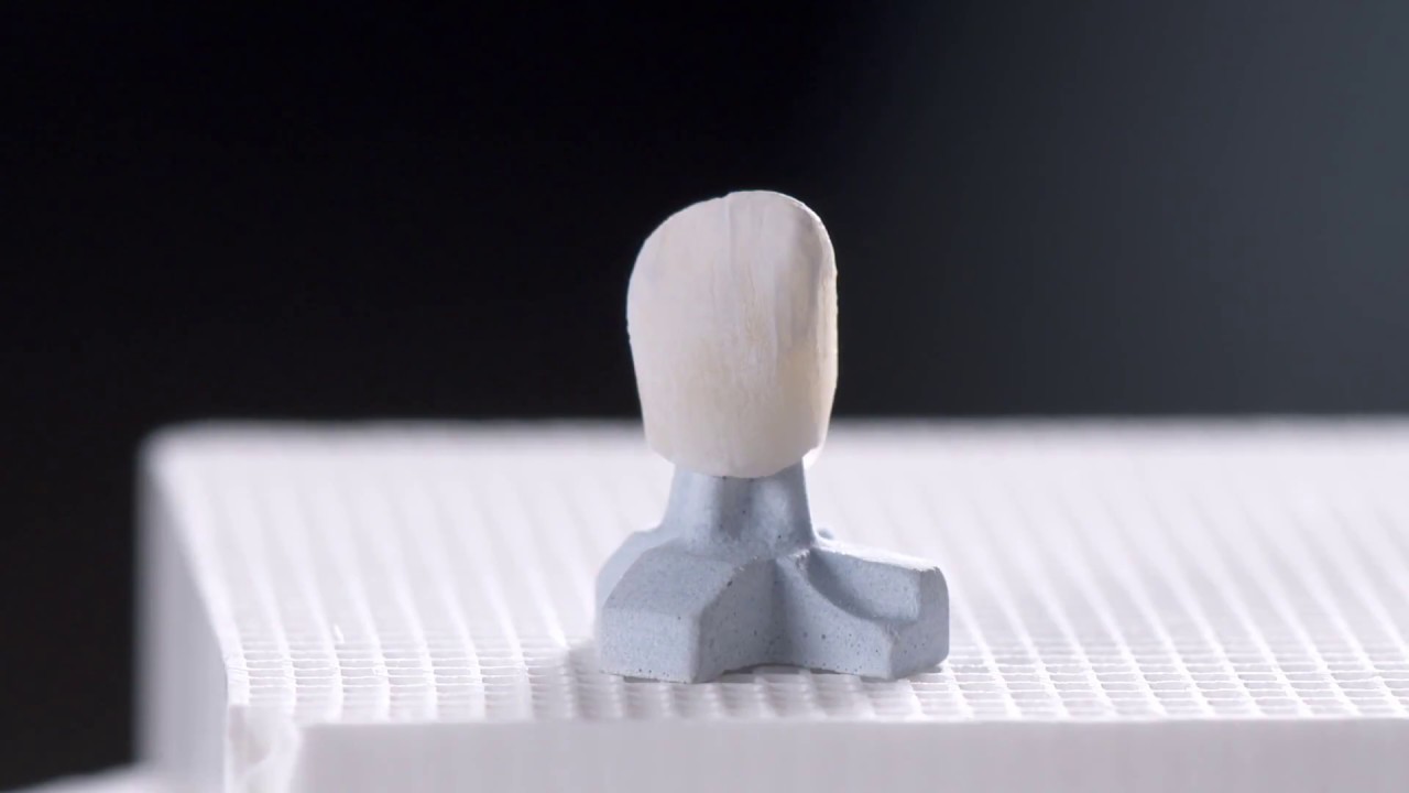 All-ceramic solutions: Monolithic - Celtra Press MT A2, Universal Stain & Glaze