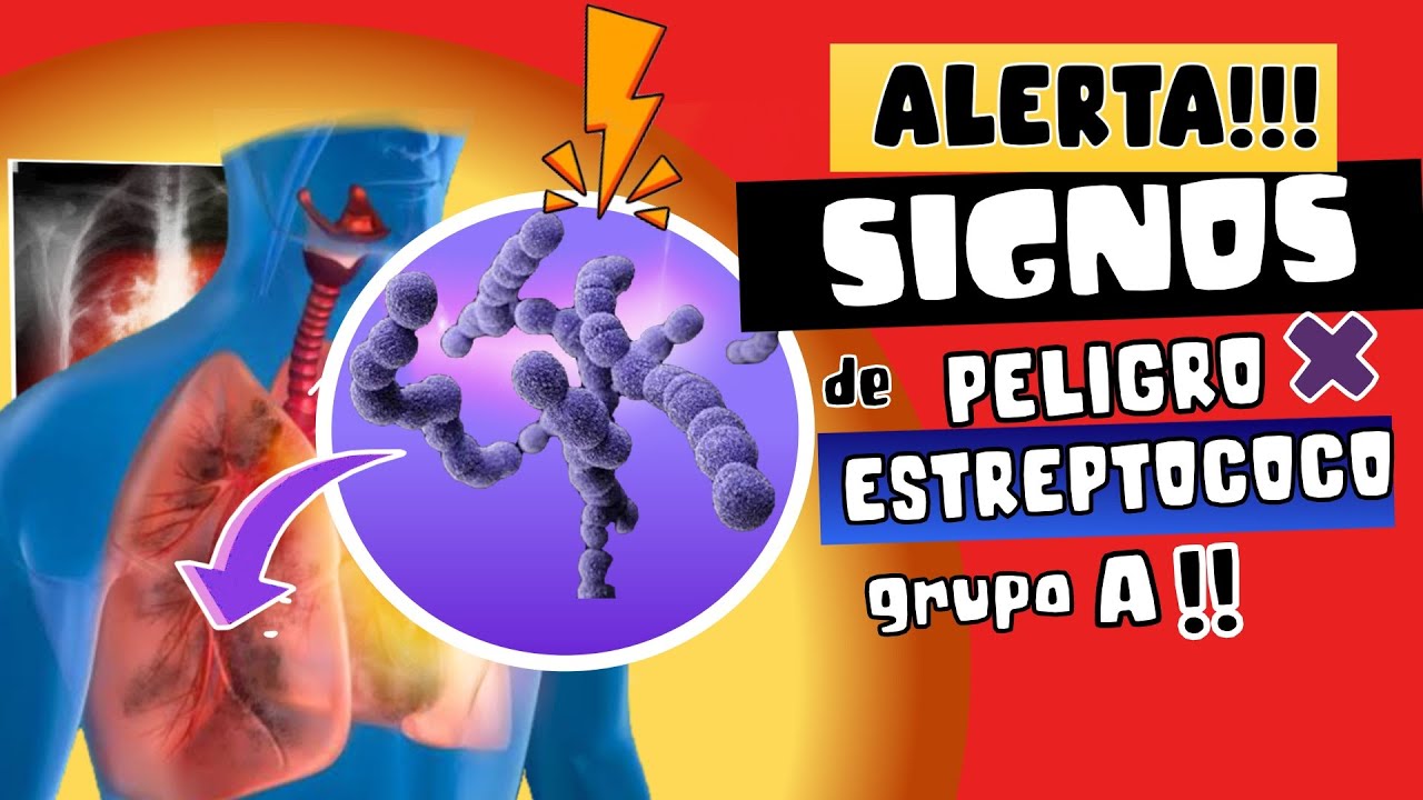 ALERTA⚠️ ESTREPTOCOCO A AVANZA EN EUROPA - SÍNTOMAS DE PELIGRO A TOMAR EN CUENTA !!!