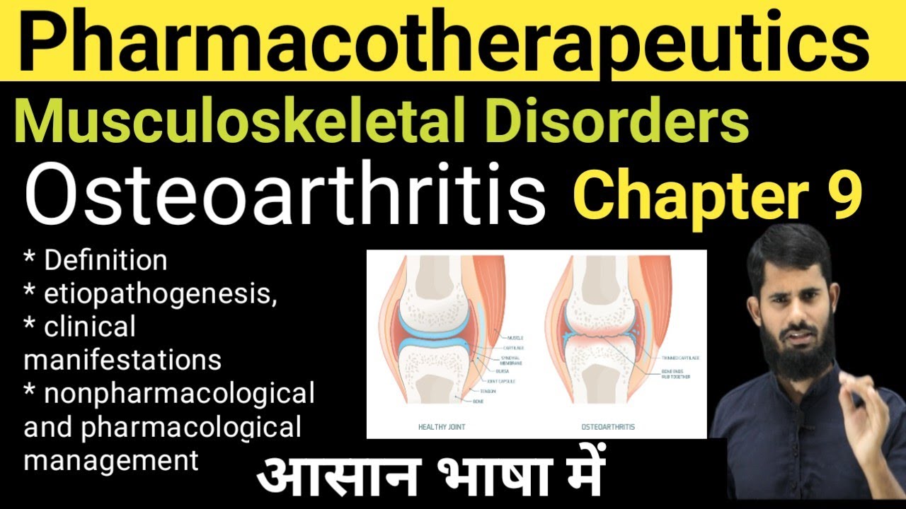 Osteoarthritis || Pharmacotheraphetics Chapter 9 Part 2 ||  Pathogenesis of Osteoarthritis