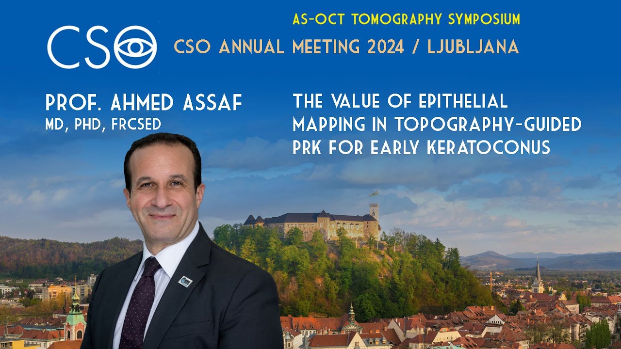 THE VALUE OF EPITHELIALMAPPING IN TOPOGRAPHY-GUIDEDPRK FOR EARLY KER ATOCONUS