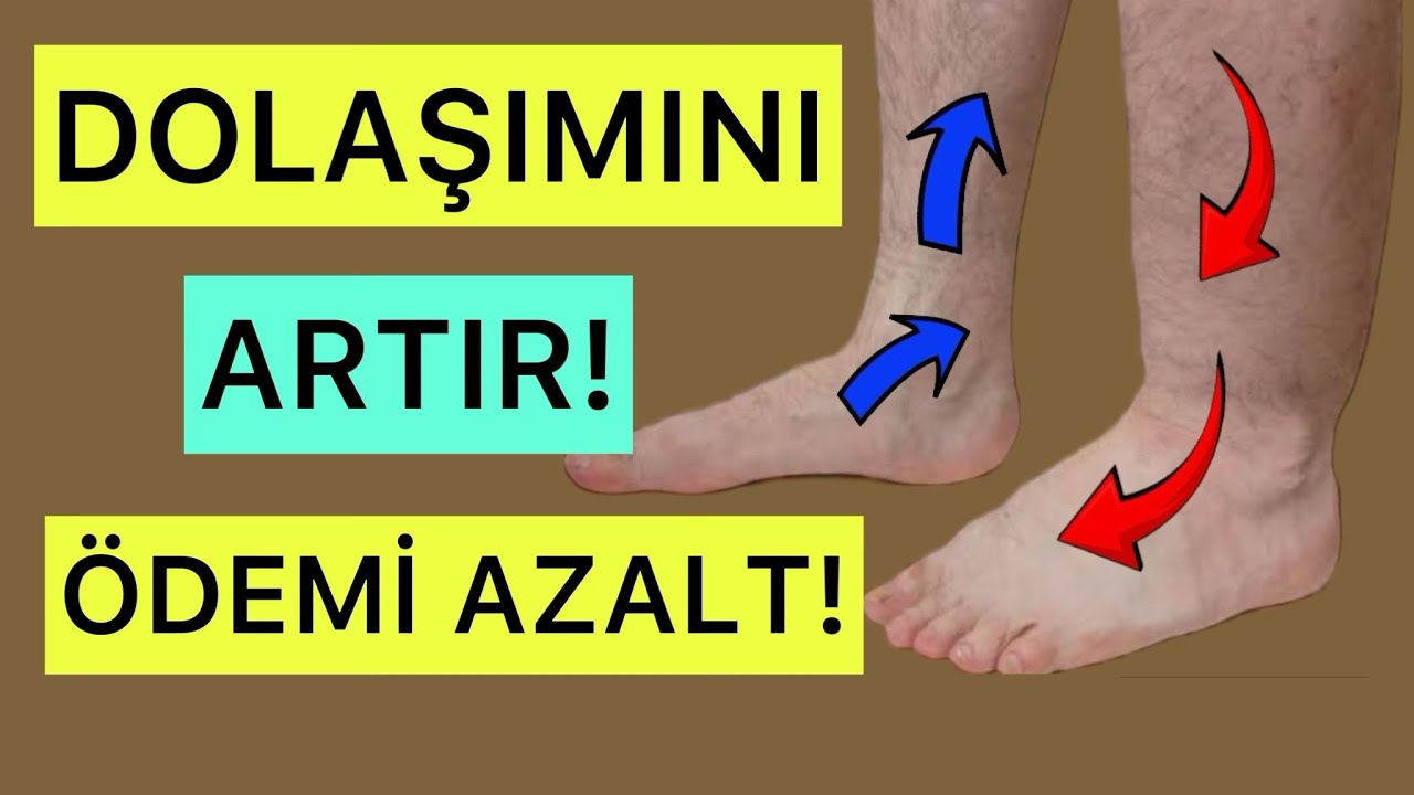 DOLAŞIMINI ARTIR! ÖDEMİ AZALT! #fizyoterapistmacide #varis #varisegzersizleri