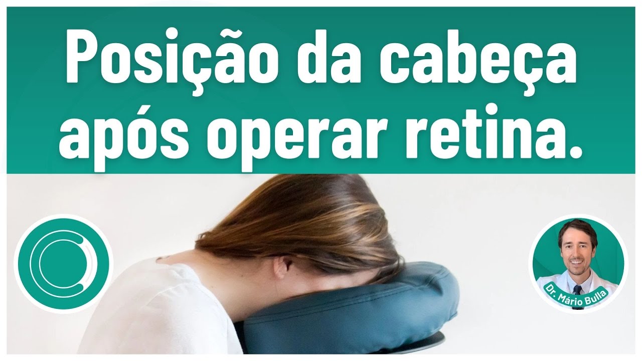 Qual a posição da cabeça após operar retina?
