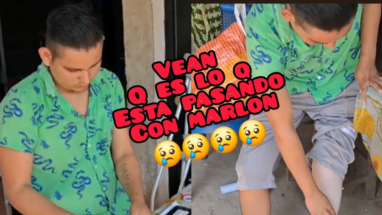 🚨El Hermano De Don Pablo Muy Triste😢Nos Cuenta Esto Sobre Su Pierna🦵😢😱 Q Sera😱😱