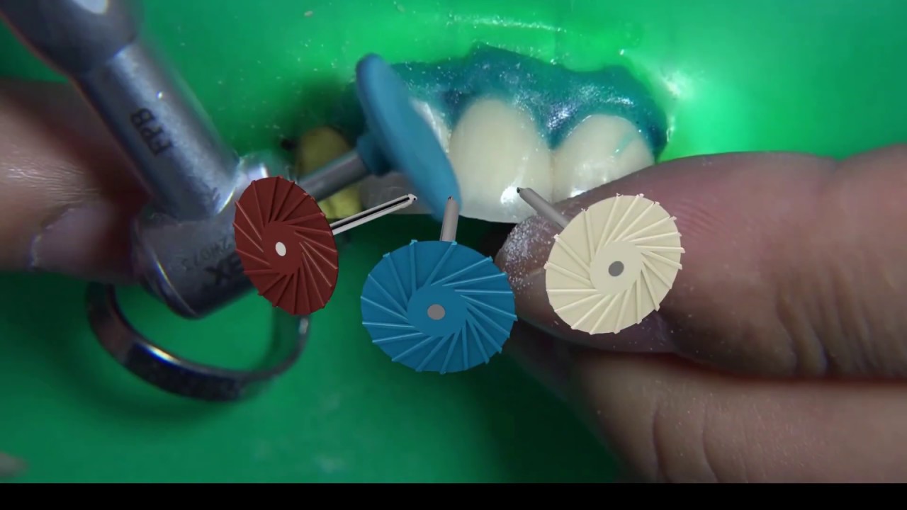 Ceramic Zirconia Metal Chipping Repair Kit