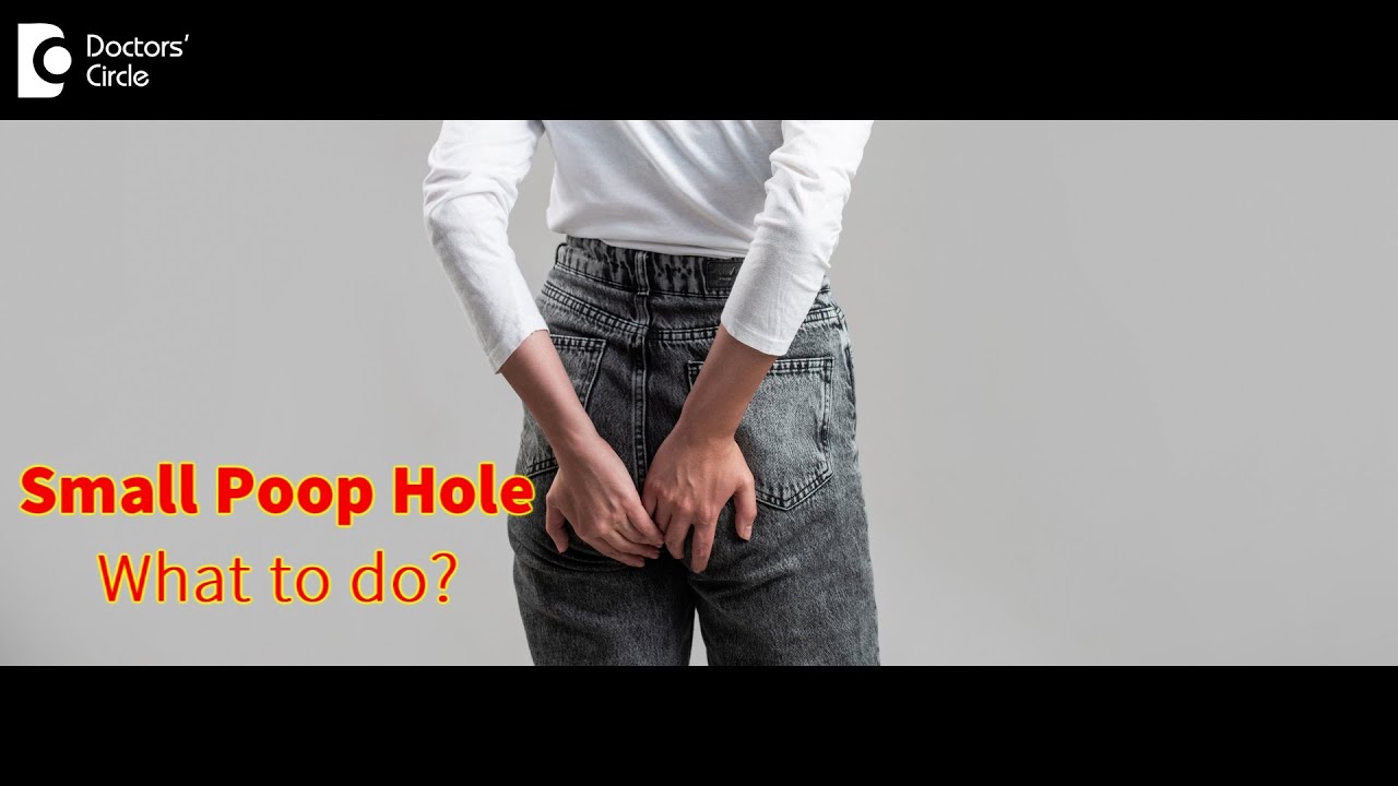 All about Anal Stenosis and Anoplasty | Does anal stenosis cause narrow stools? - Dr. Rajasekhar M R