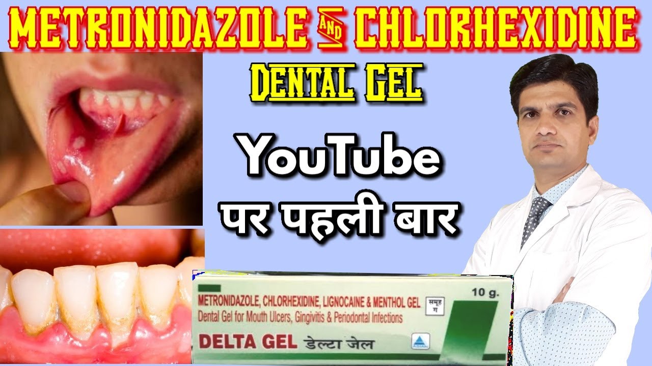 Metronidazole & chlorhexidine gluconate dental gel | tooth pain relief gel | mouth ulcer gel