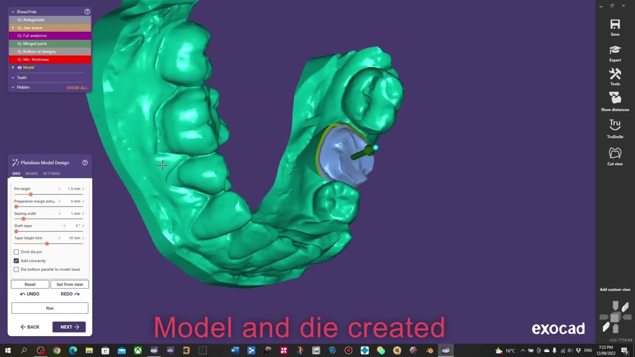 Using Exocad Model Creator to create a die for a single crown