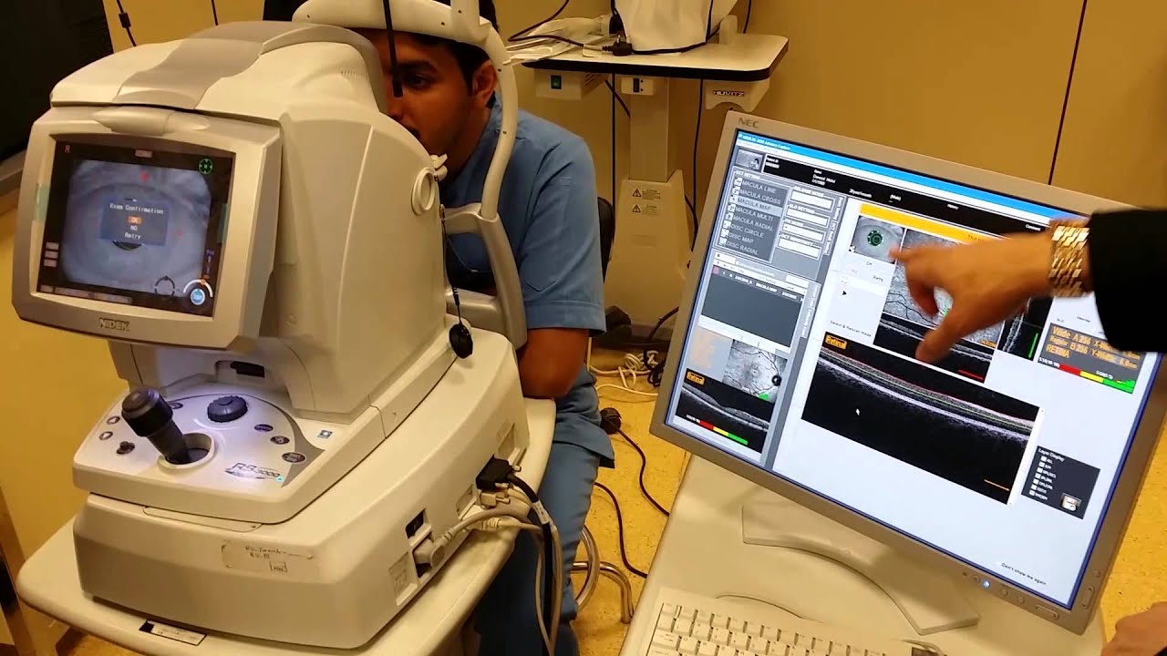 شرح جهاز optical coherence tomography (OCT) 3-3