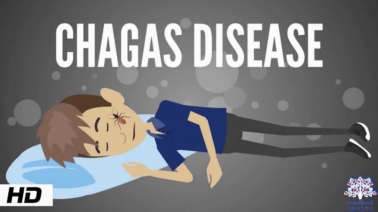 Chagas Disease, Causes, Signs and Symptoms, Diagnosis and Treatment