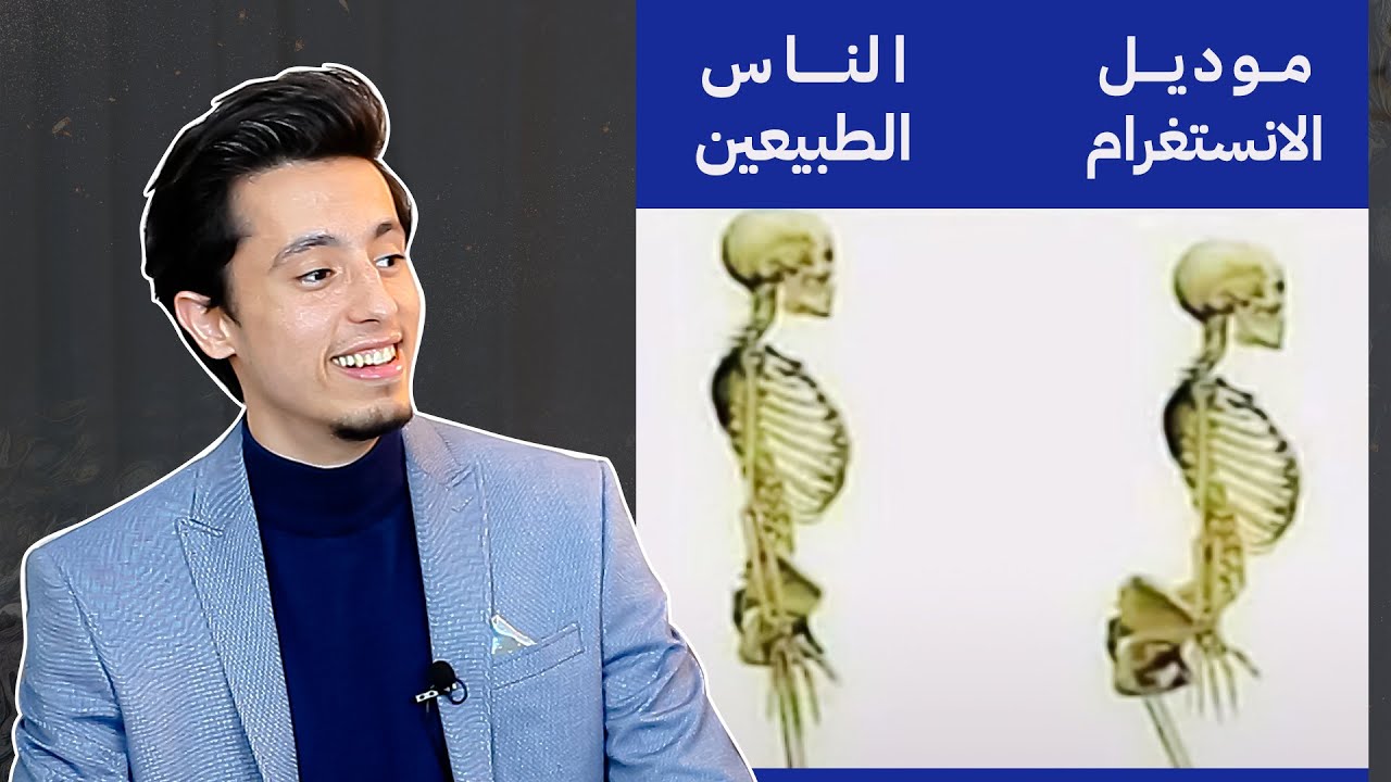 دكتور يعلق على ميمز طبية غريبة 😅