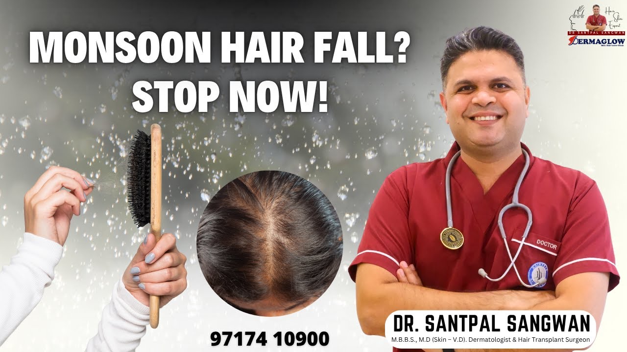 Why Hair Fall Increases During Monsoon | Expert Solution by Dr. Santpal Sangwan