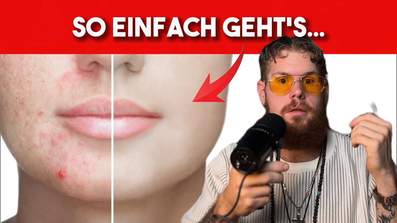 Es g&auml;be keine Akne, wenn das jeder w&uuml;sste..