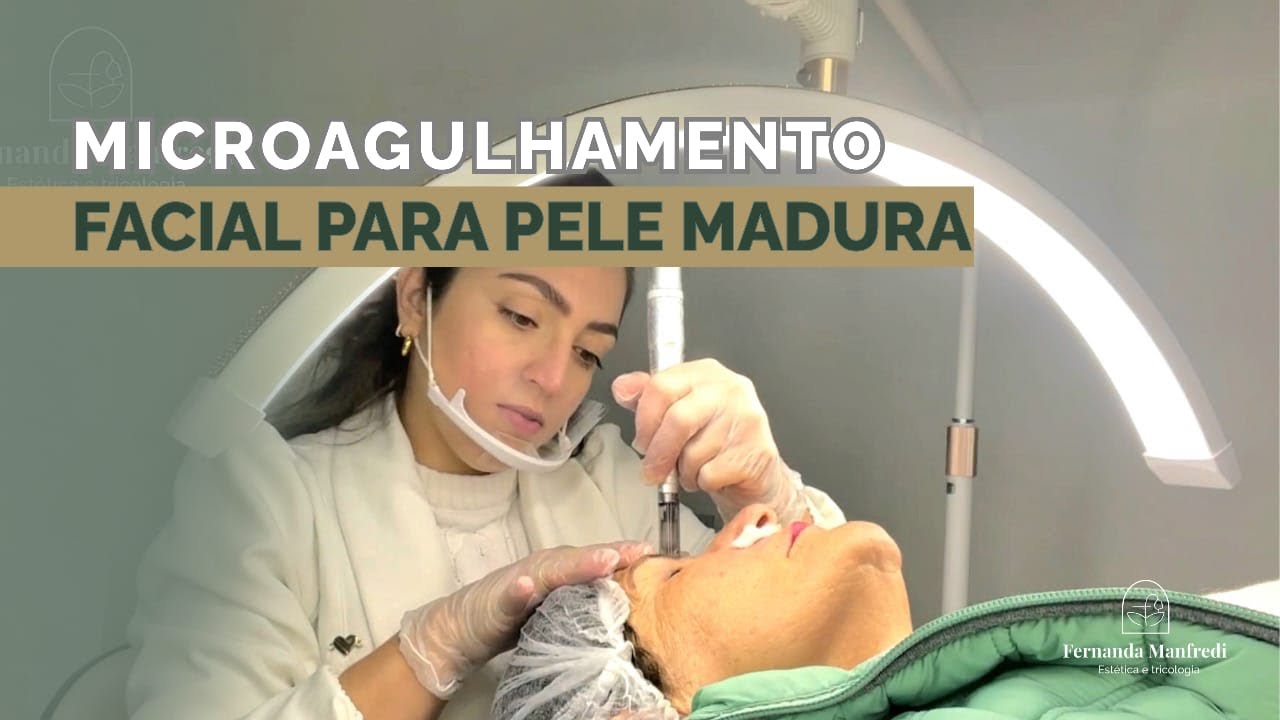 Microagulhamento em Pele Madura | Dermapen e Ativos para Rejuvenescimento