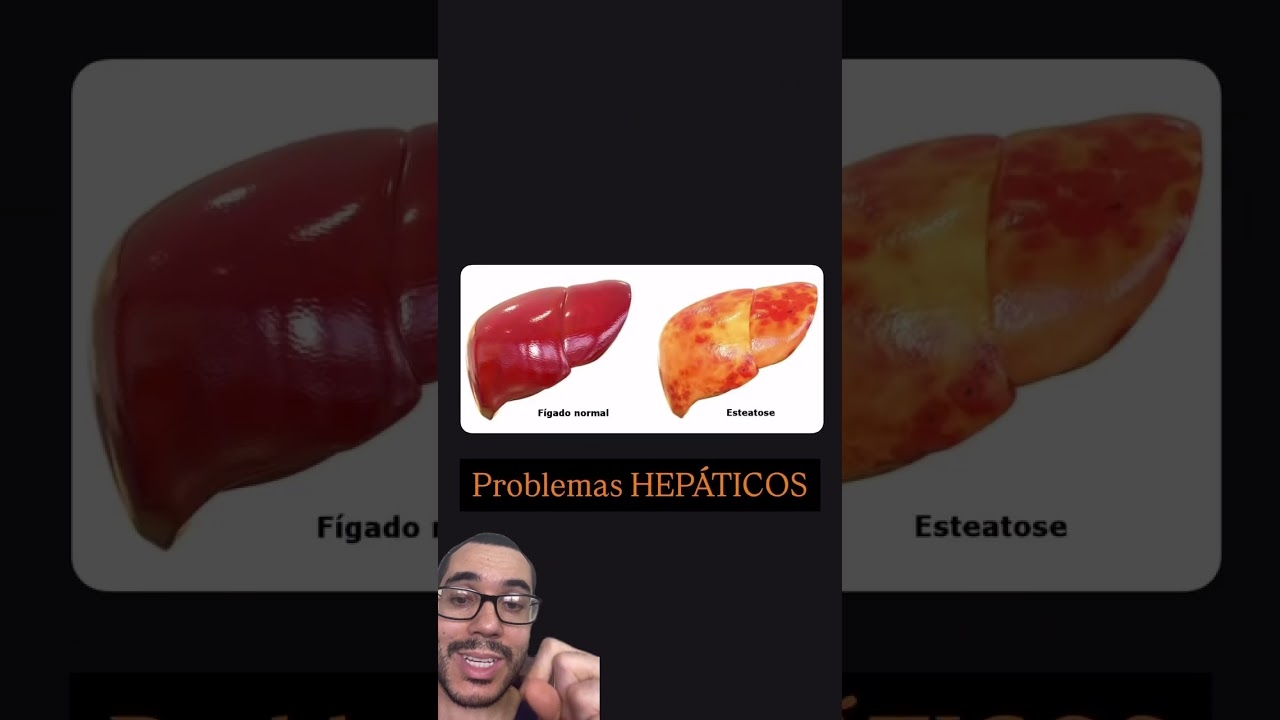 PERIGO SILENCIOSO! Não Ofereça Pão Para o Seu Cachorro ou Seu Gato.
