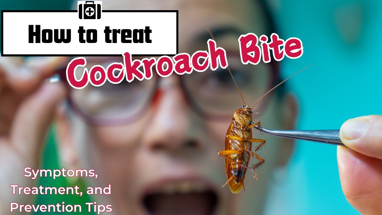Cockroach Bites: Symptoms, Treatment, and Prevention Tips