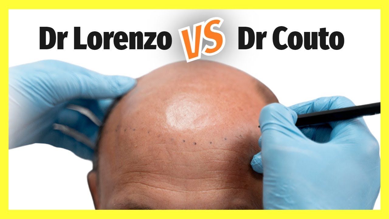 Dr.  Lorenzo  ⚡ Dr.  Couto | Injerto Capilar Opiniones
