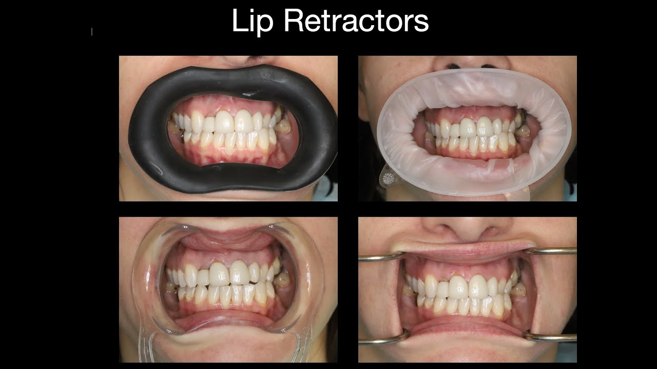 VisionButler The autoclavable, reusable ,lip and cheek retractor / photocontrastor