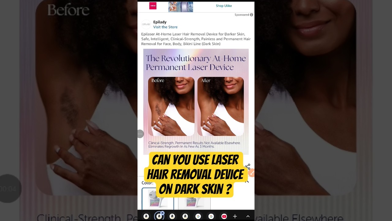 Can You Use Laser Hair Removal on Dark Skin? The Real Answer Explained 