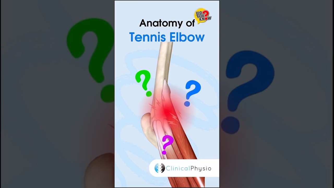 Tennis Elbow Anatomy #physicaltherapy #physiotherapy #tenniselbow #lateralepicondylitis