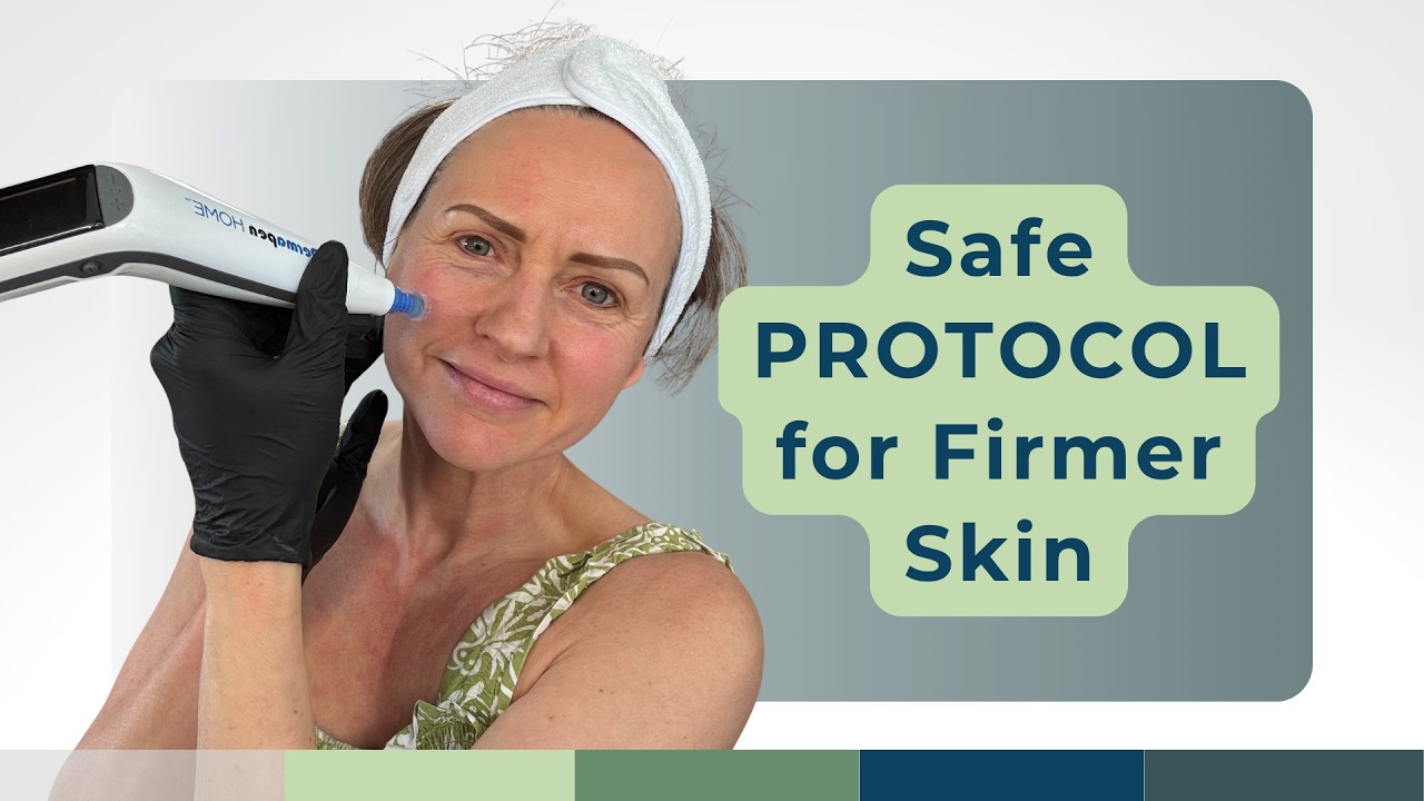 Microneedling at Home Over 50: The 4P System That Actually Works
