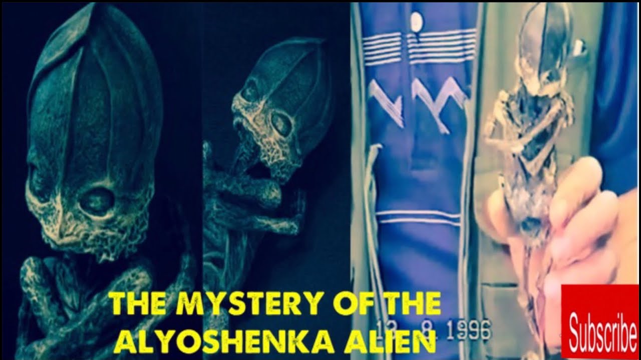 Russias Alien: The mystery of Alyoshenka