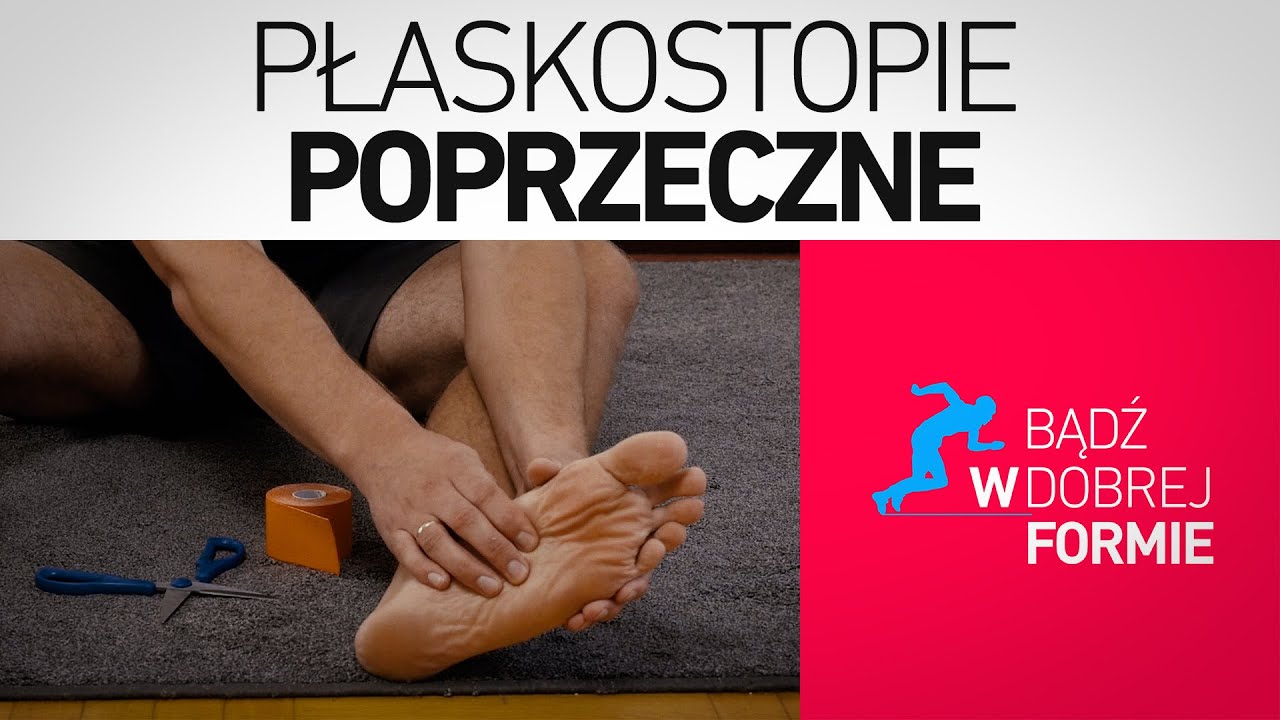 Płaskostopie poprzeczne + KINESIOTAPING