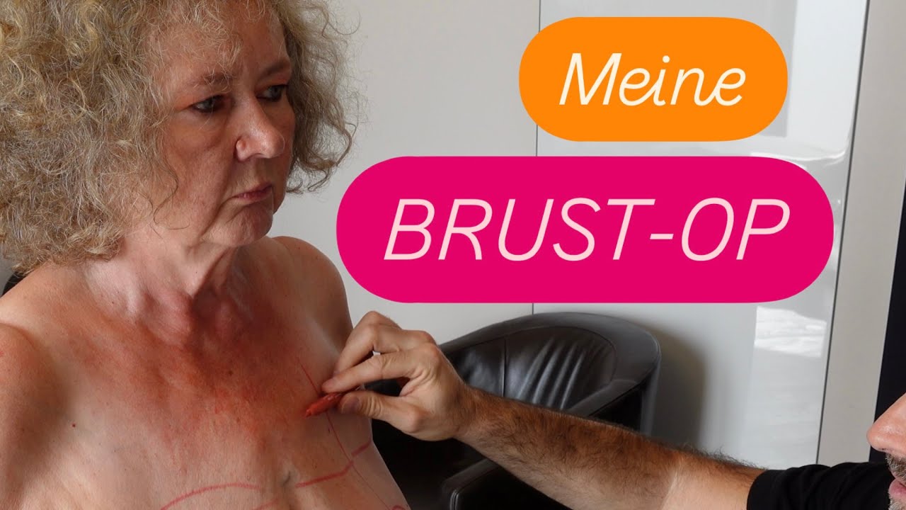 MEINE BRUSTVERKLEINERUNG: Das Vorgespräch