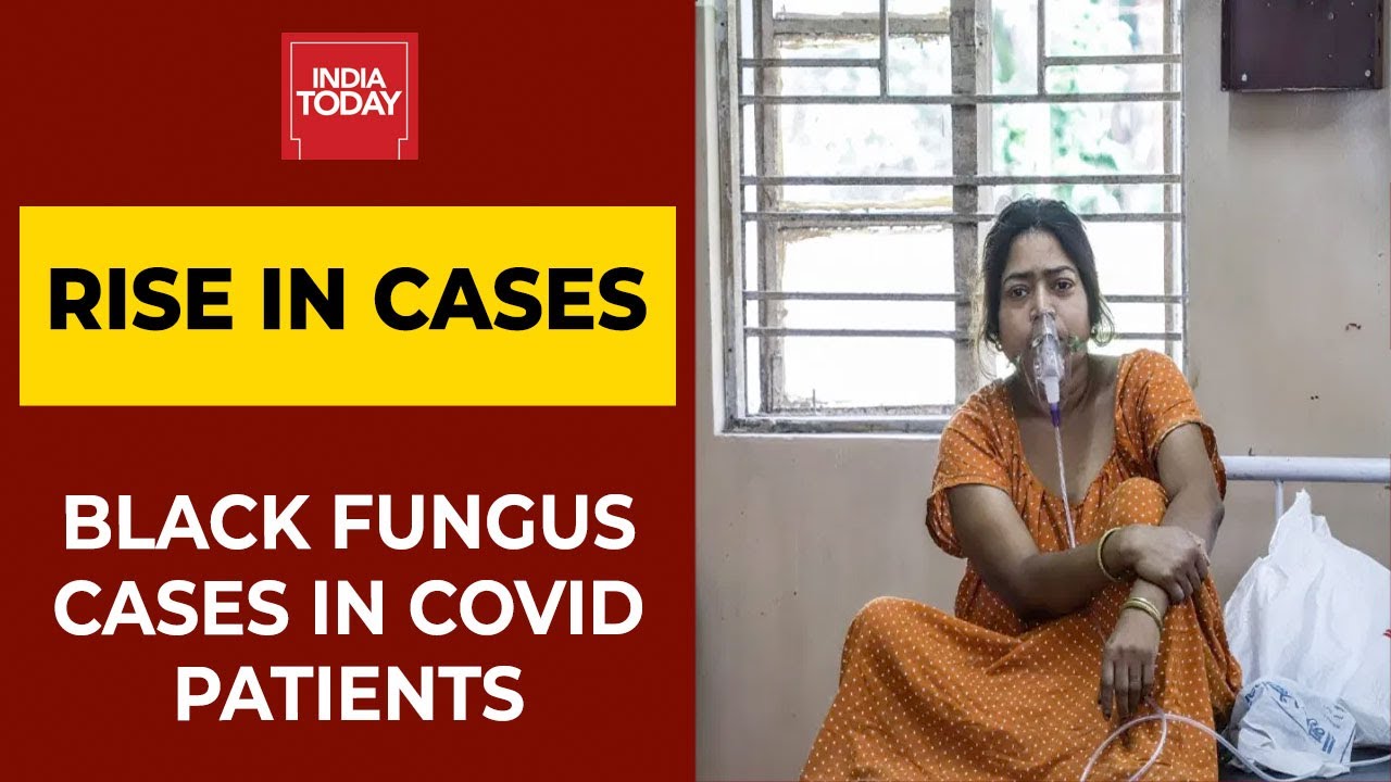 Black Fungus Outbreak | AIIMS' Norms To Treat Mucormycosis To Be Released Soon