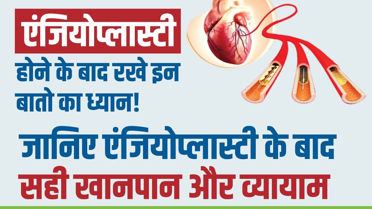 एंजियोप्लास्टी के बाद सही खान पान और व्यायाम | Care After Angioplasty? I Dr. Pankaj Harkut