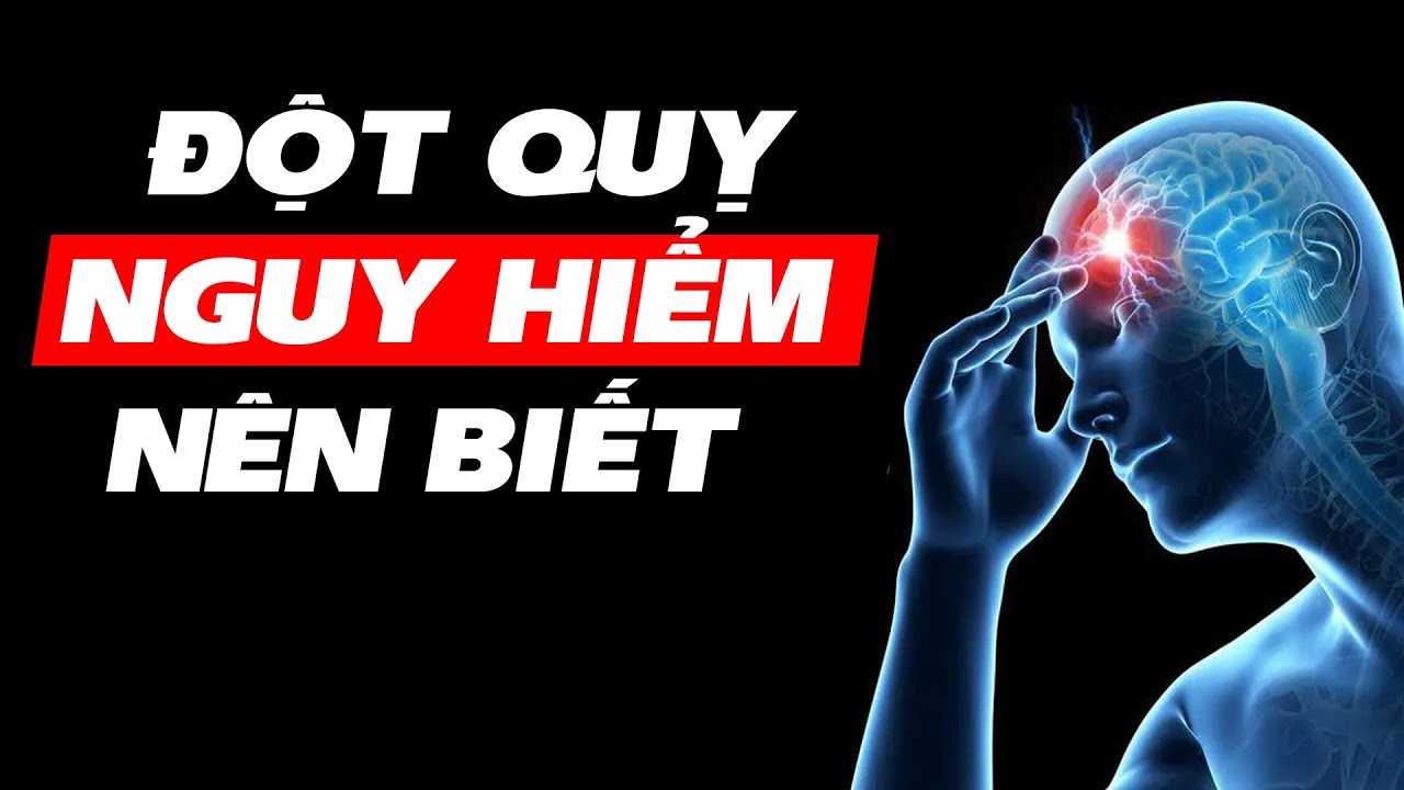Đột quỵ là gì? Tại sao ngày càng nhiều người bị?