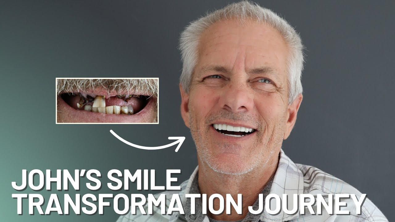 Dental Implants Changed His Life | John’s All-on-X Journey at Stubbs Dental