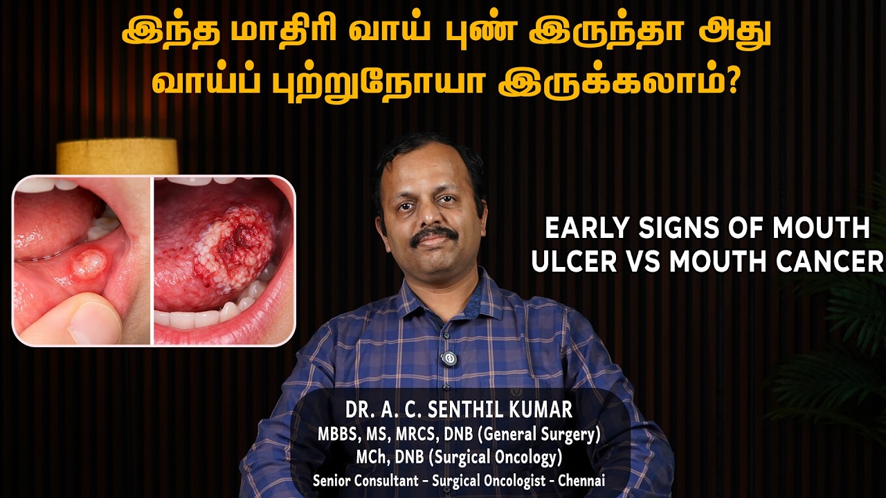 Mouth Ulcer or Oral Cancer? Warning Signs & Symptoms Explained in Tamil